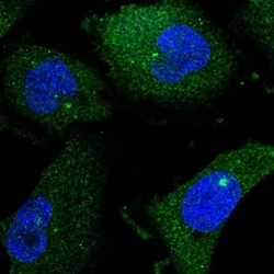 ENGASE Antibody, Novus Biologicals:Antibodies:Primary Antibodies